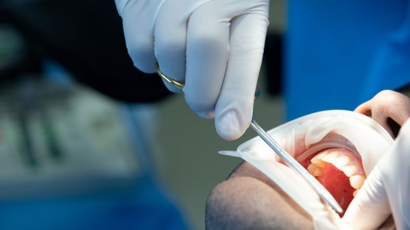 dentista-herramienta-realiza-alg